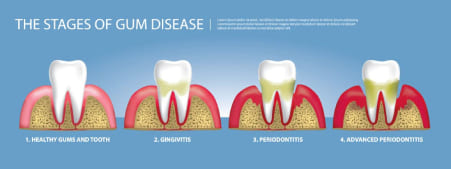 Meso Dental