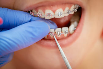 assets/services/orthodontic-treatment.jpg