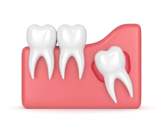 Meso Dental